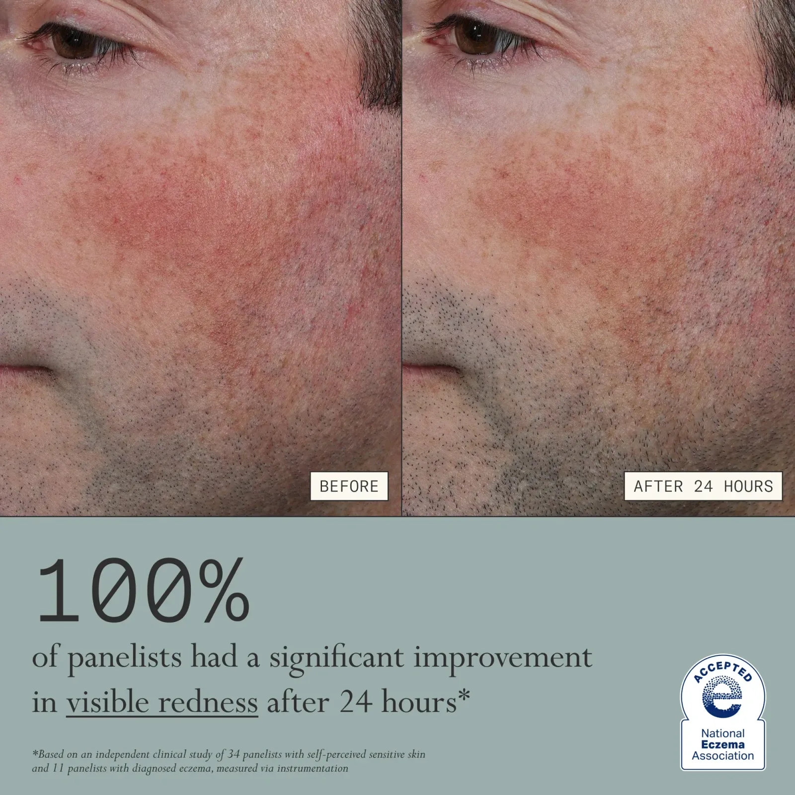 Skin Mercy Recovery Cream