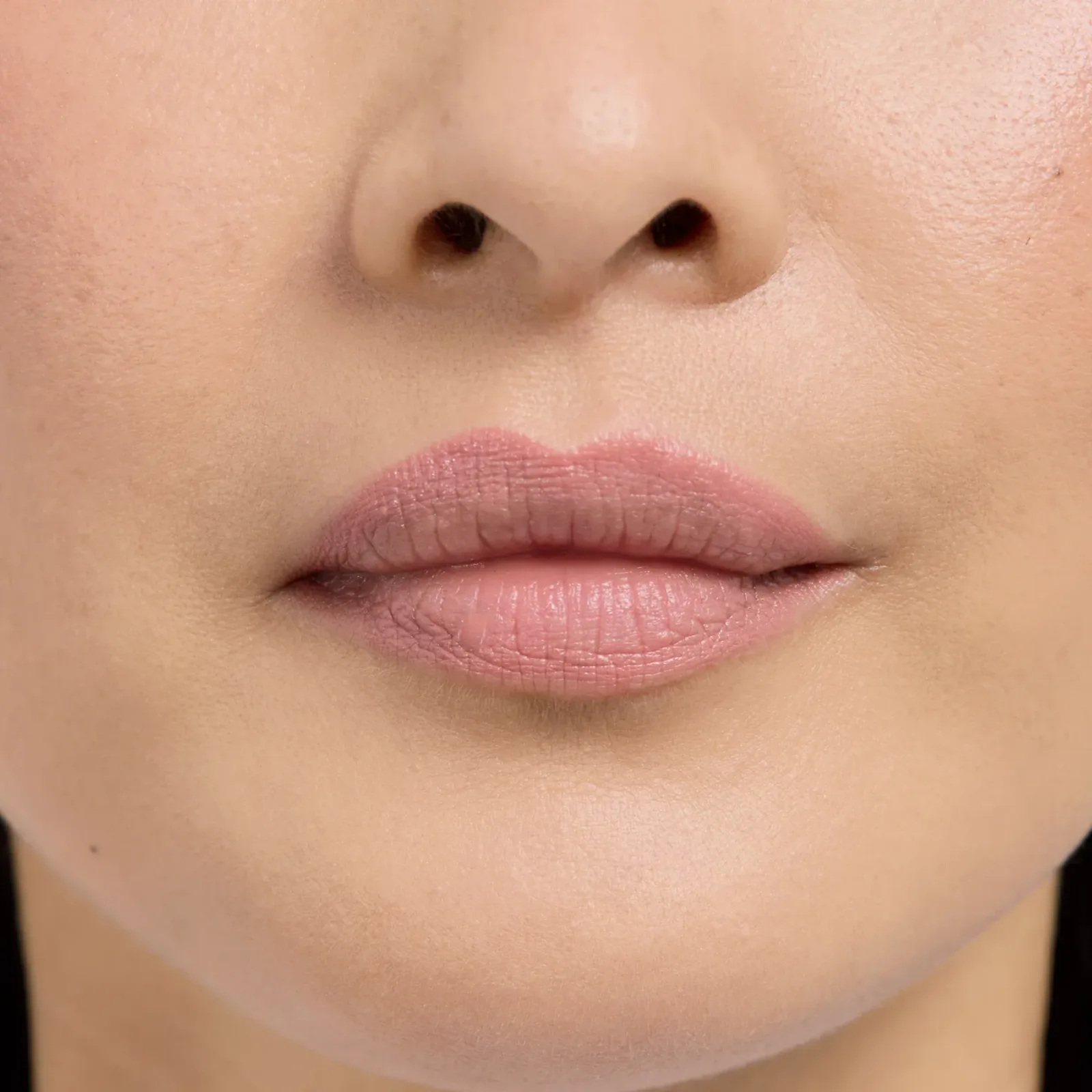 Lip Frame