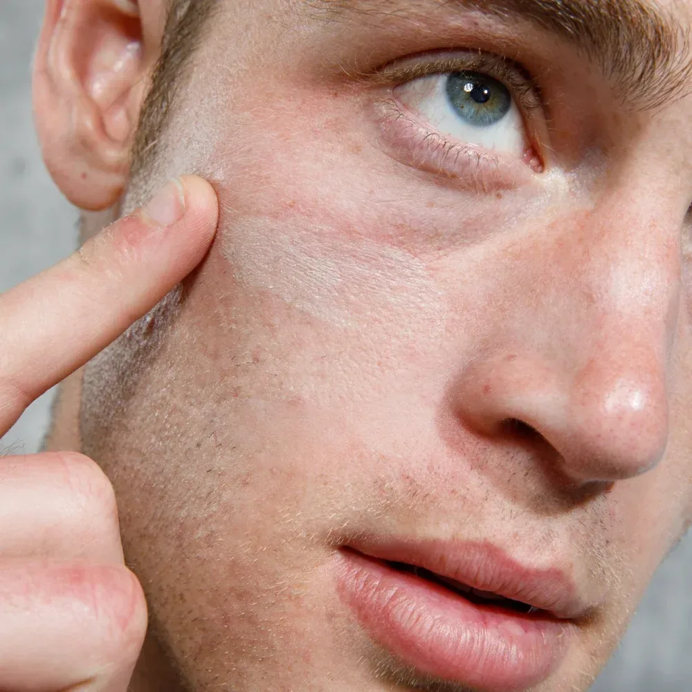 Instant Redness Corrector