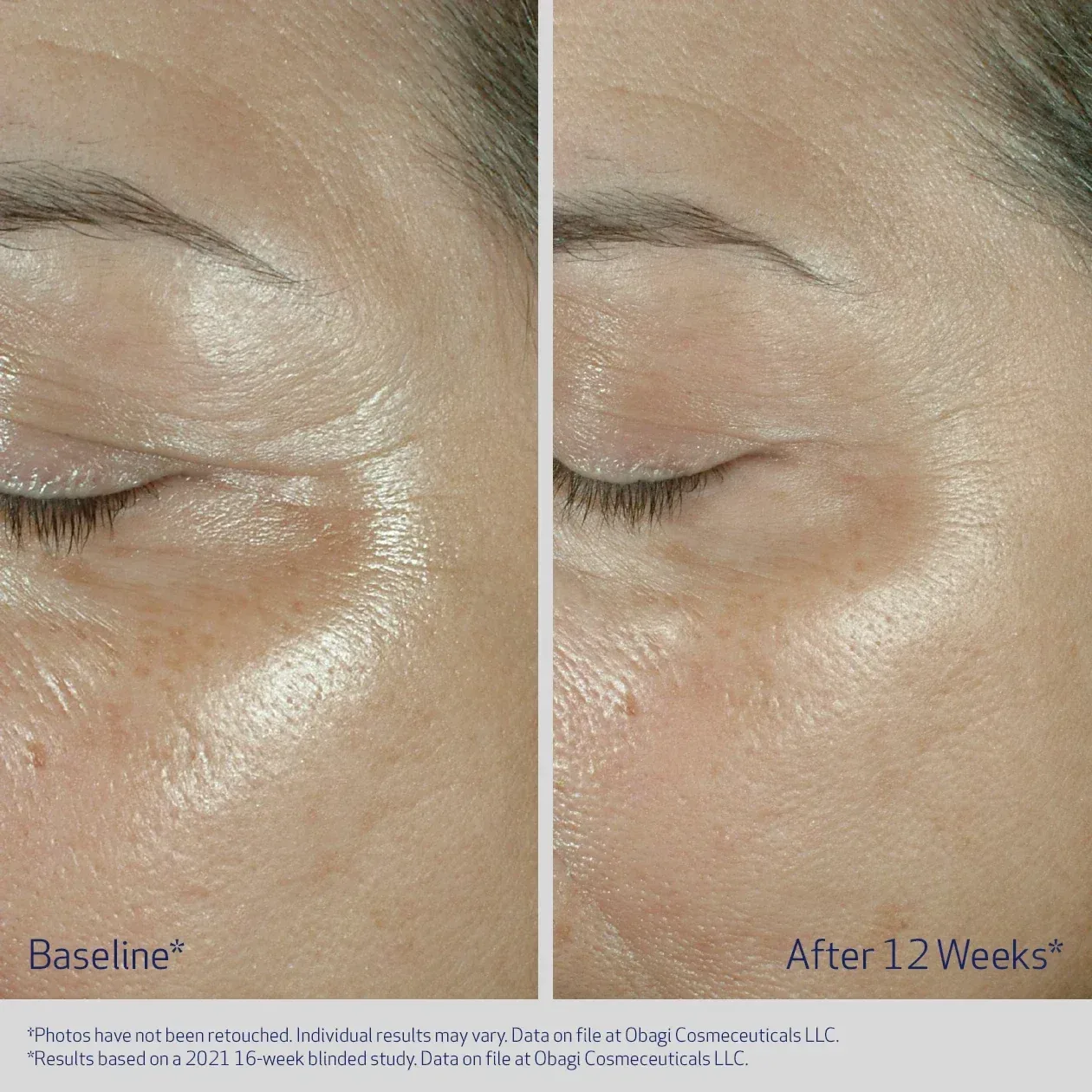 Firming Eye Cream