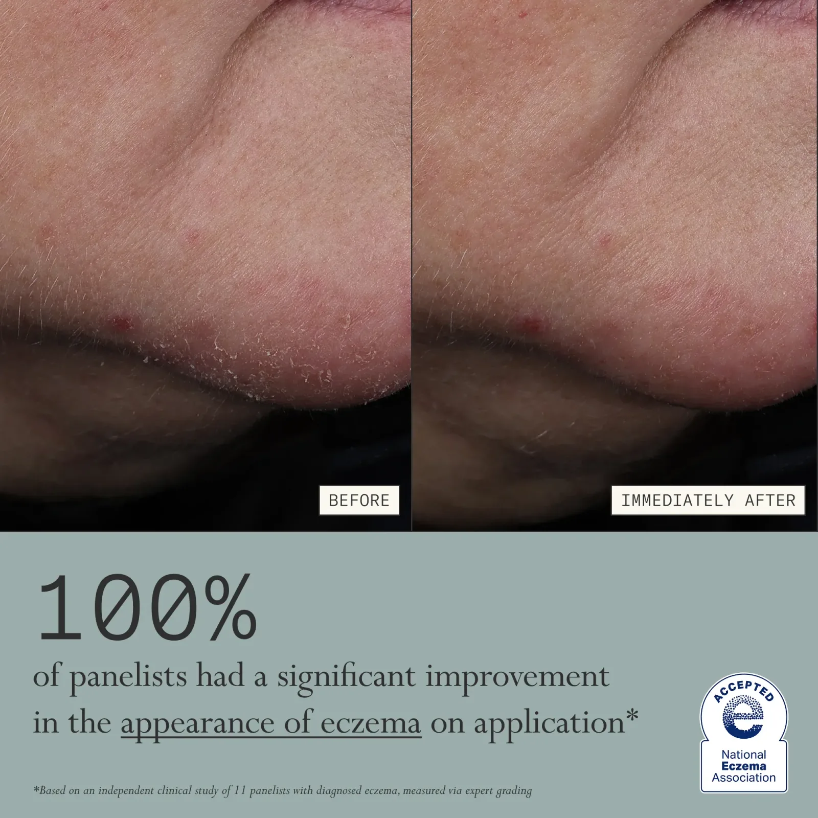 Skin Mercy Recovery Cream