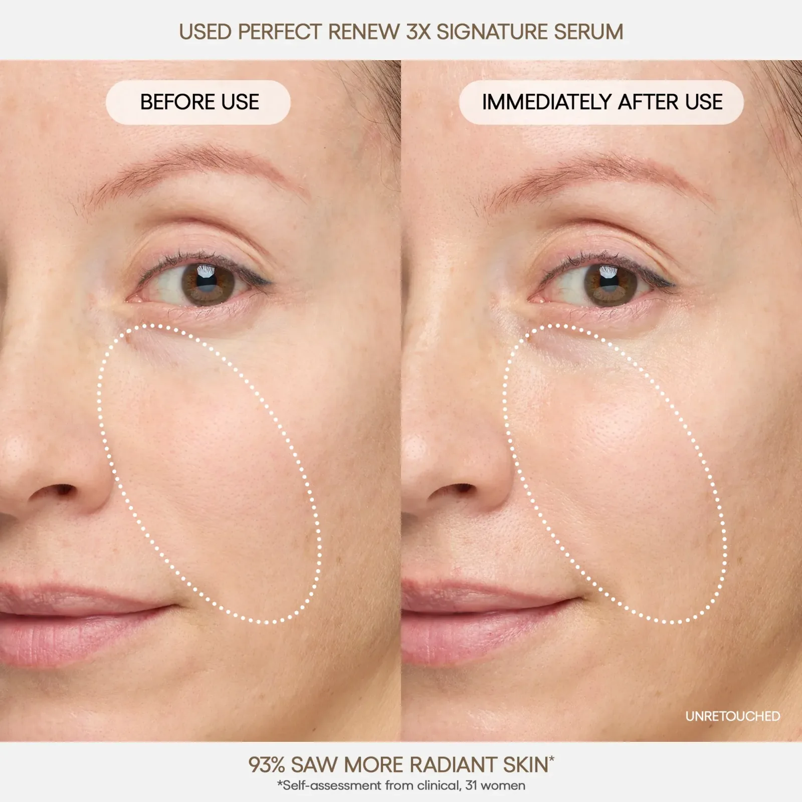 Perfect Renew 3X Signature Serum